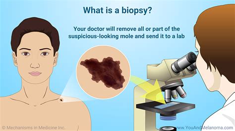 Slide Show - Diagnosing Melanoma