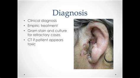 Otitis Externa - USMLE Step 2 Review - YouTube