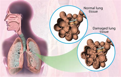 Health Condition : Symptoms, Causes, Treatment and More