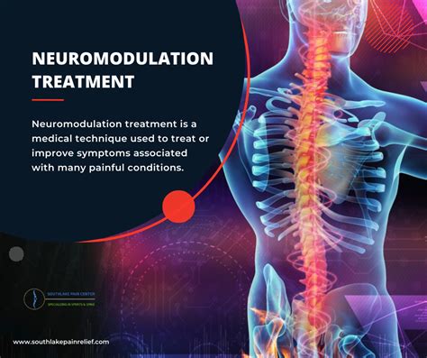 Neuromodulation Treatment in Southlake, TX – South Lake Pain Center ...