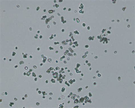 urine cytology test - DrBeckmann