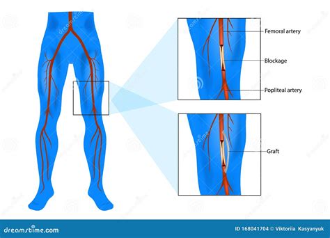 Femoral Artery A Femoralis The Arteries Of The Lower