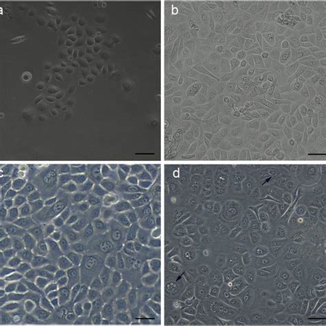 (PDF) In vitro differentiation of menstrual blood stem cells into keratinocytes: A potential ...