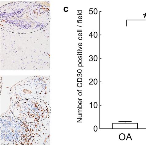 Analysis of CD30-positive cells in synovial tissue of patients with ...