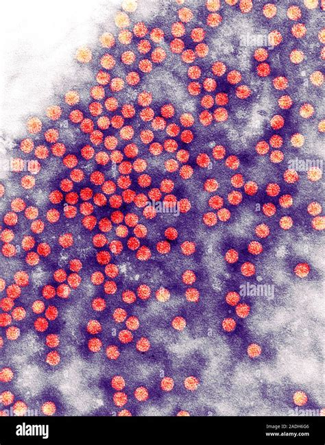 Cucumber mosaic virus. Coloured transmission electron micrograph (TEM) of virus particles ...