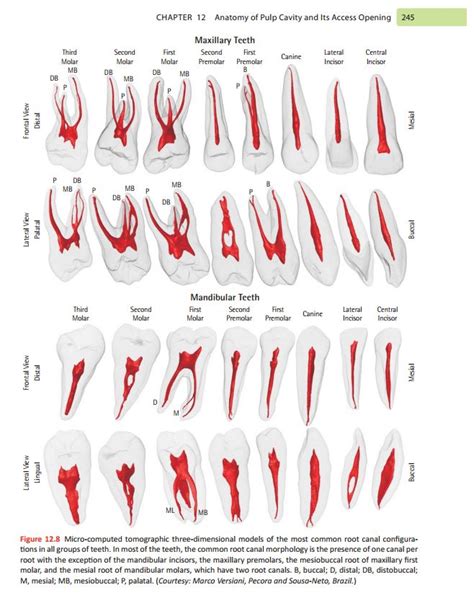 Max vs. Mand: Roots, Canals | Dental hygiene school, Dental assistant study, Dental anatomy