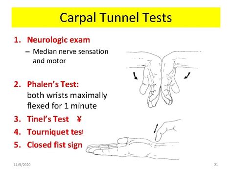 1152020 1 Carpal Tunnel Syndrome Carpal Tunnel Syndrome