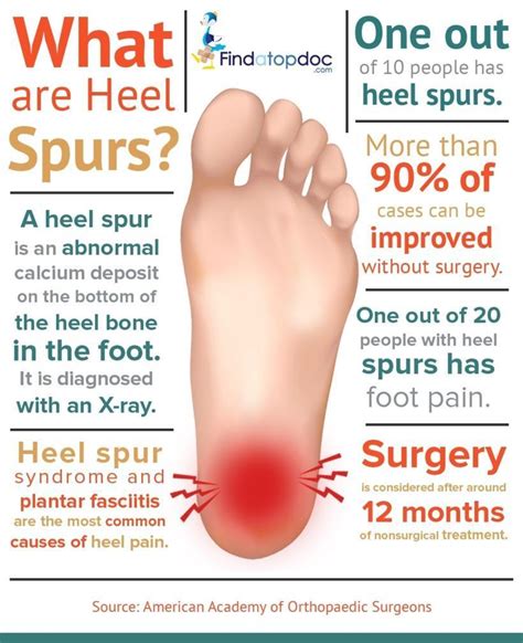 Heel Spur Surgery