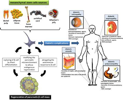 Mesenchymal Stem Cell Therapy in Type 1 Diabetes Mellitus and Its Main Complications: From ...