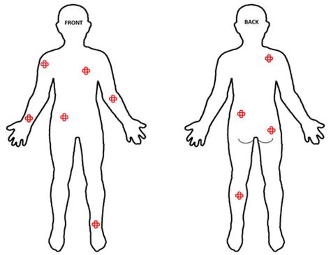 best nicotine patch placement - Zita Whitman