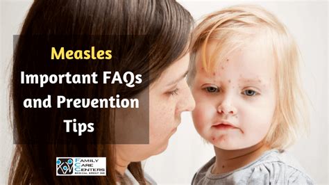 Measles FAQs & Prevention Tips for Orange County Residents