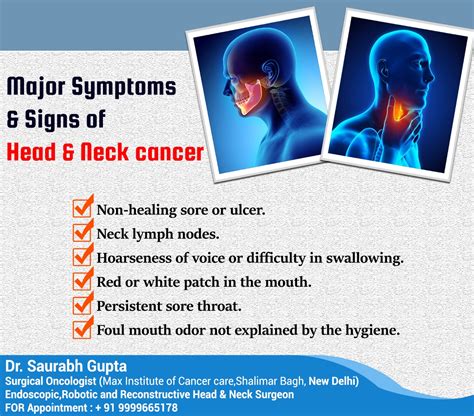 Dr. Saurabh Gupta Oncologist: Major Symptoms & Signs of Head & Neck Cancer