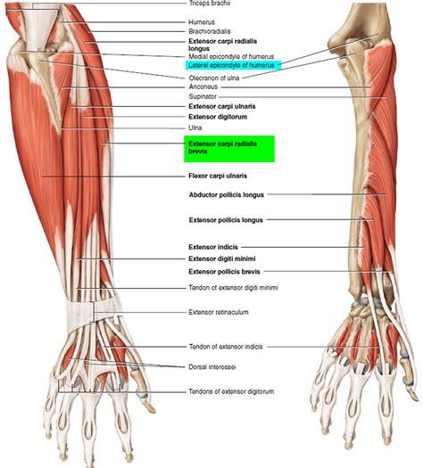 Tendonitis - Patellar, Peroneal, Knee, Foot, Wrist, Biceps, Shoulder, Elbow