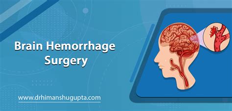 Brain Hemorrhage Surgery and Treatment in Jaipur - Dr. Himanshu Gupta