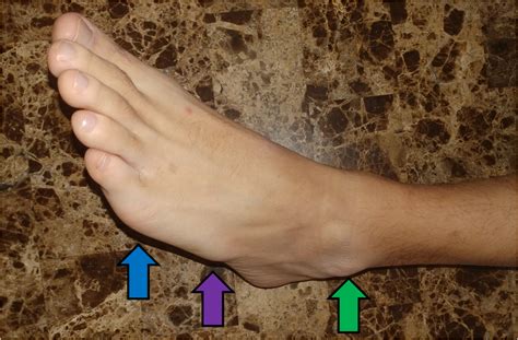 Surface Anatomy of the Foot