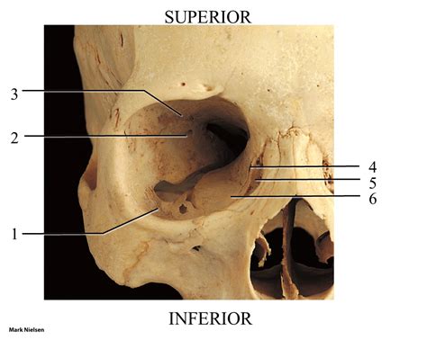 Orbit bones Diagram | Quizlet