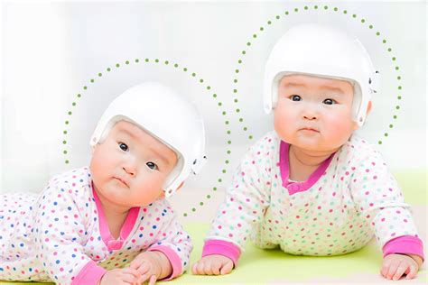 Plagiocephaly Facts