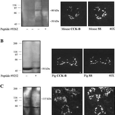 Ontogeny of the rat pancreatic CCK B /gastrin receptor protein. A : 30... | Download Scientific ...