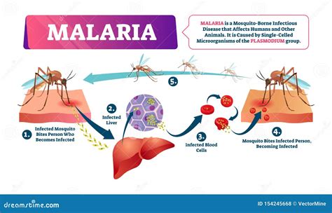 Ejemplo Del Vector De La Malaria Enfermedad Infectada Sangre De La Mordedura De Mosquito ...