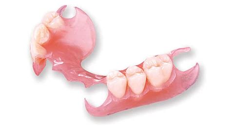 Flexible Partial Dentures in Los Algodones - DSA