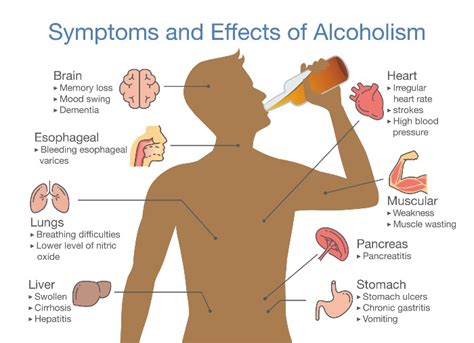 What Are The Symptoms Of Alcoholic Liver Disease Word Less Design | My ...