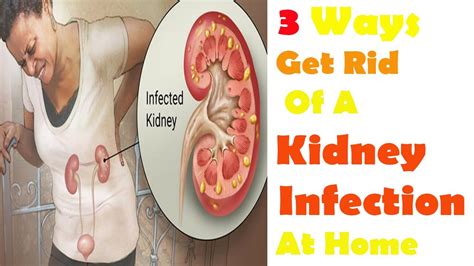 Does Nitrofurantoin Get Rid Of Kidney Infection - HealthyKidneyClub.com