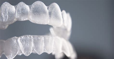 How to Clean Retainers: Tips and Tricks