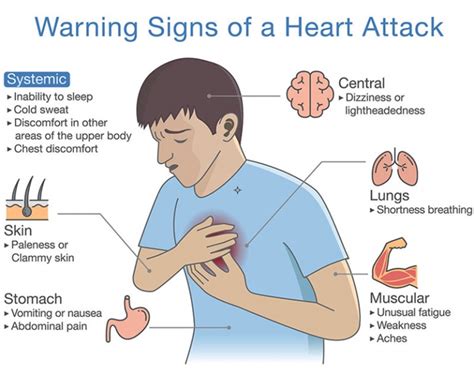 Stock Diagram about warning signs of a heart attack. Illustration about disease symptoms when ...