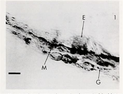 Figure 1 from Neurofilament-Like Immunoreactivity | Semantic Scholar