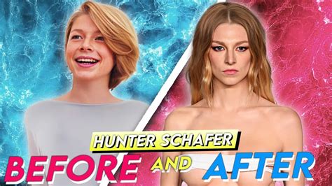 Hunter Schafer | Before & After | Plastic Surgery Transformation