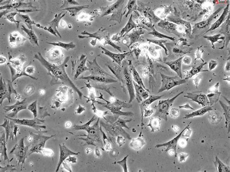 Human Villous Trophoblasts, HVT