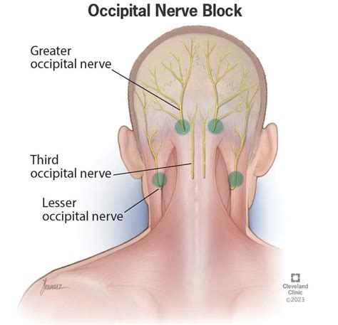 Occipital Lymph Node Location