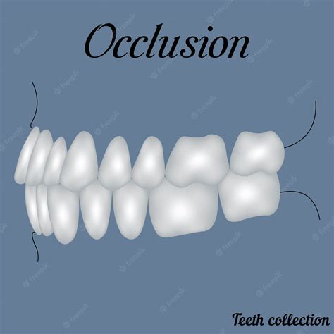 Premium Vector | Occlusion side view