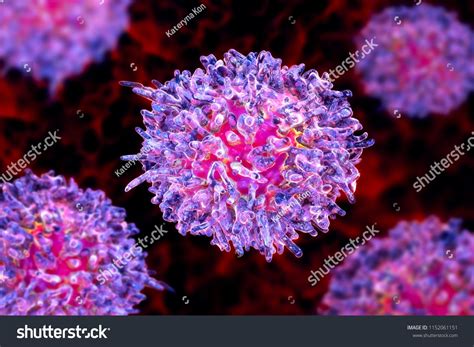 Hairy cell leukemia, 3D illustration. It is a hematological malignancy, chronic lymphocytic ...