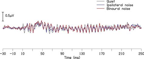 Grand averaged waveforms of the speech auditory brainstem response in ...