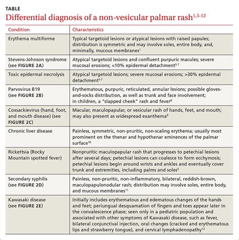 Mildly pruritic palmar rash | MDedge Family Medicine