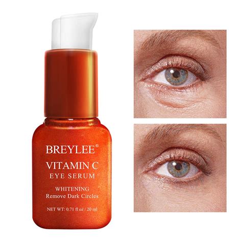 Amazon.com: Vitamin C Eye Serum, BREYLEE Whitening Eye Treatment for Dark Circles and Wrinkles ...