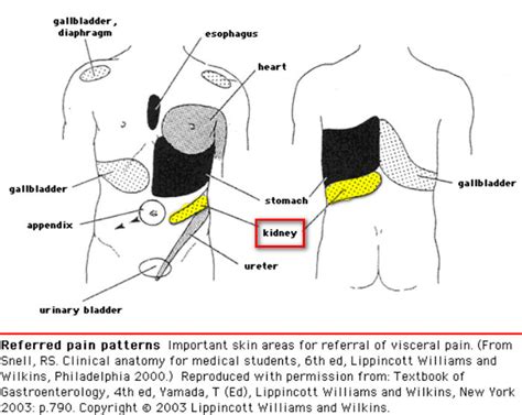 Kidney Pain - (Location, anatomy), lower back, Vs Back pain, Causes, Treatment - (2018 - Updated)