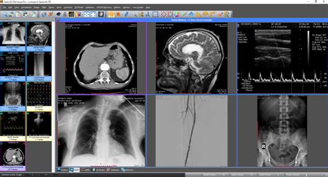 Sante DICOM Viewer Pro | Santesoft LTD