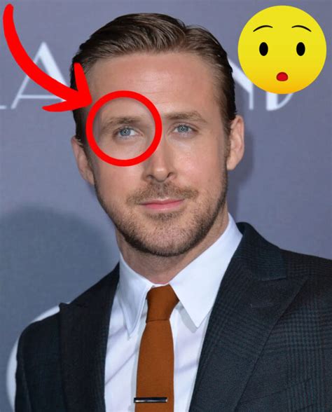 Ryan Gosling lazy eye - Does he have strabismus? - Equal-Eyes