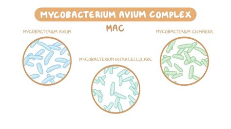 Mycobacterium avium complex (NORD) - Osmosis