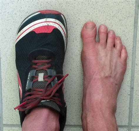 Embrace the space. The story about Altra's FootShape toe box - Conrad Stoltz XTERRA Triathlete