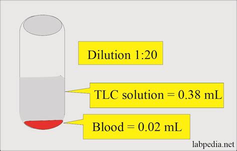 White blood cell:- Part 2 – Total Leukocytes Count Procedure, TLC Solution Preparation ...