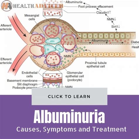 Albumen Causes Symptoms Treatment Albumen