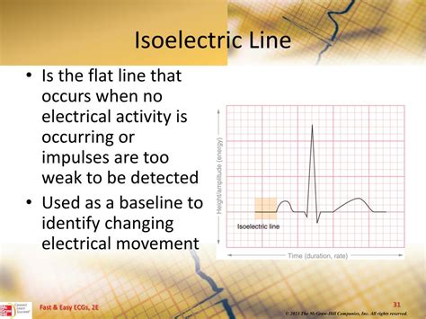 PPT - The Electrocardiogram PowerPoint Presentation, free download - ID ...