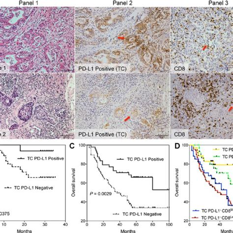 Expression of PD-L1, PD-1, and CD8 by immune cells that infiltrated ...