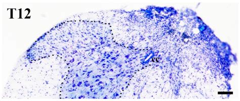 Substantia Gelatinosa Histology