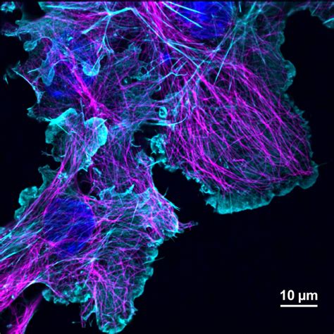 Lasers for Fluorescence Microscopy - HÜBNER Photonics