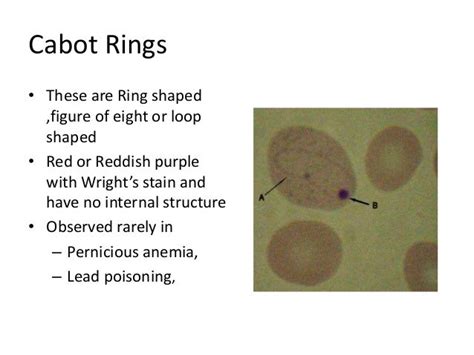 Peripheral blood smear examination