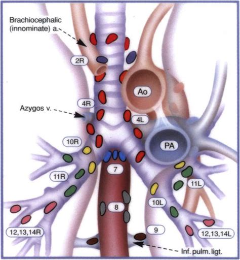 Pulmonary Ligament Lymph Node | Images and Photos finder